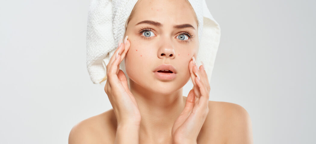 Skin care pelle a tendenza acneica: come avere cura della pelle impura